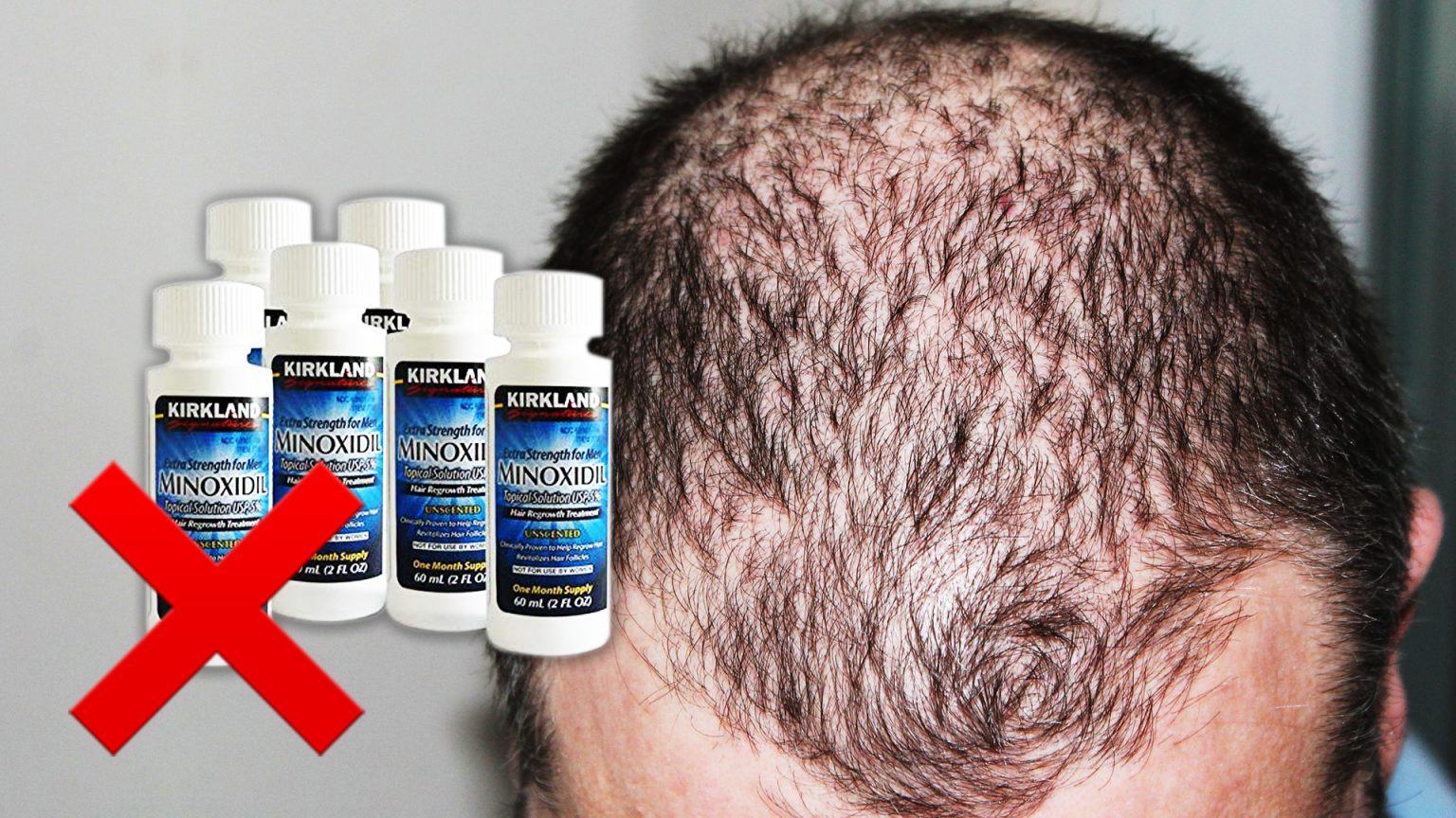 how-effective-are-topical-stimulants-at-stopping-hair-loss-online